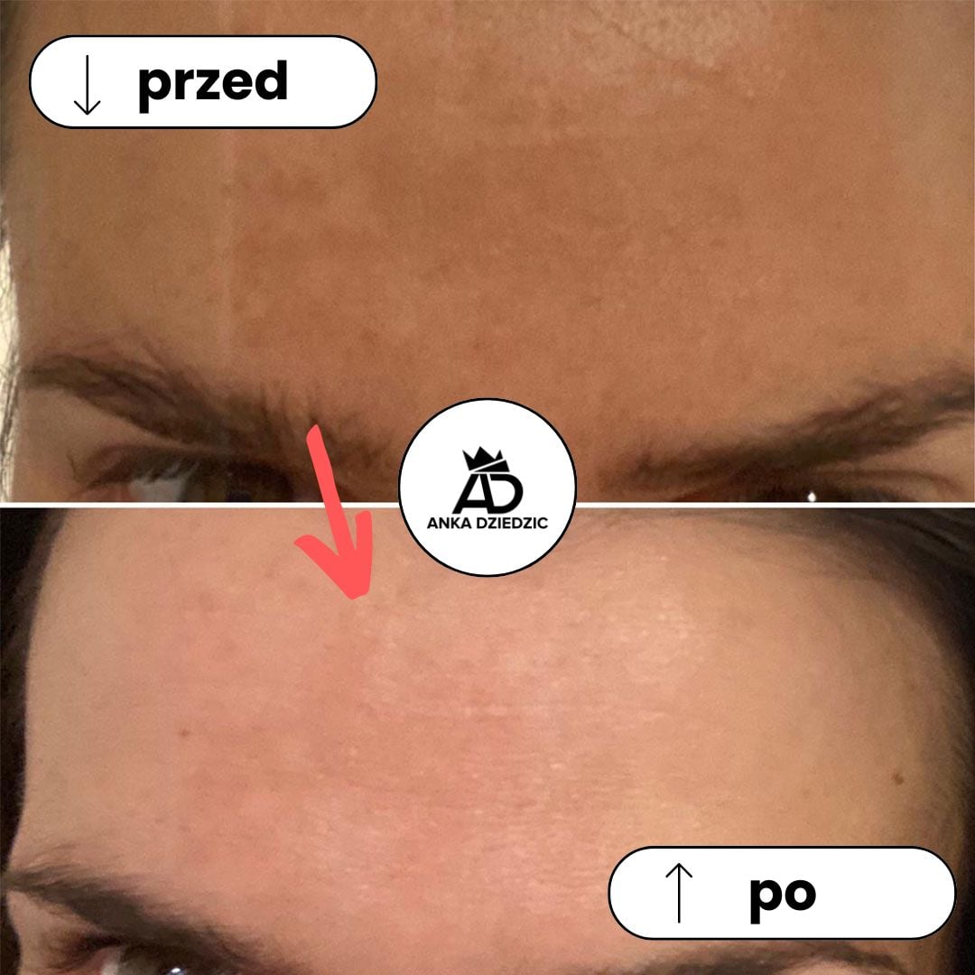 CareLab Krem Na Przebarwienia