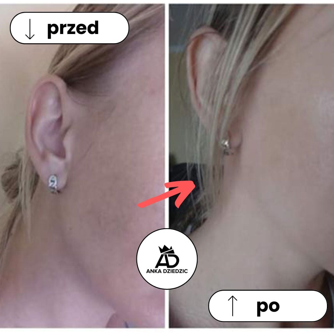 CareLab Krem Na Przebarwienia