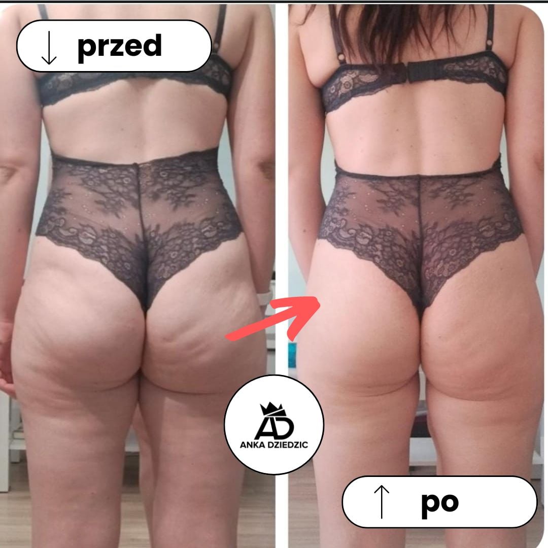 FitLab Krem Antycellulitowy (dawniej: Przedtreningowy)