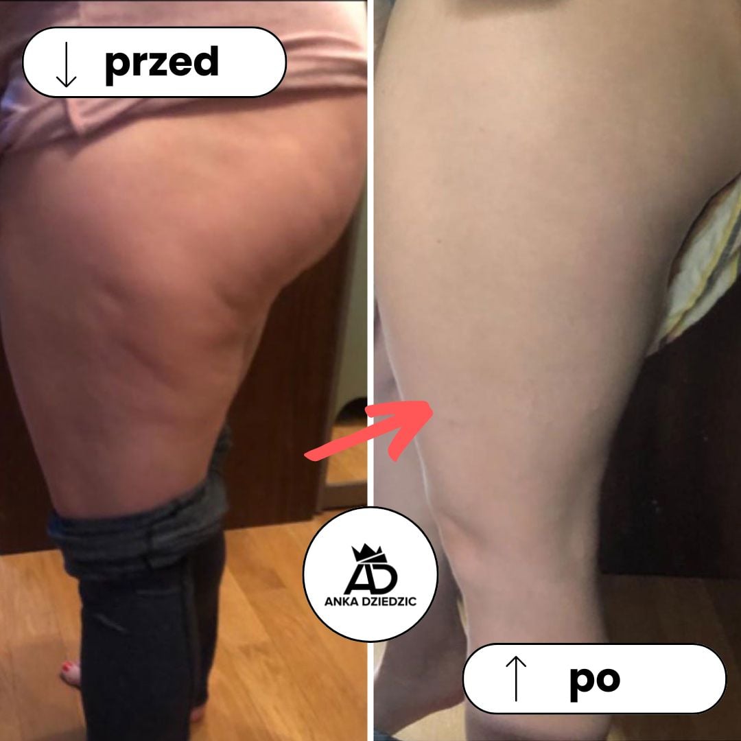 FitLab Krem Antycellulitowy (dawniej: Przedtreningowy)