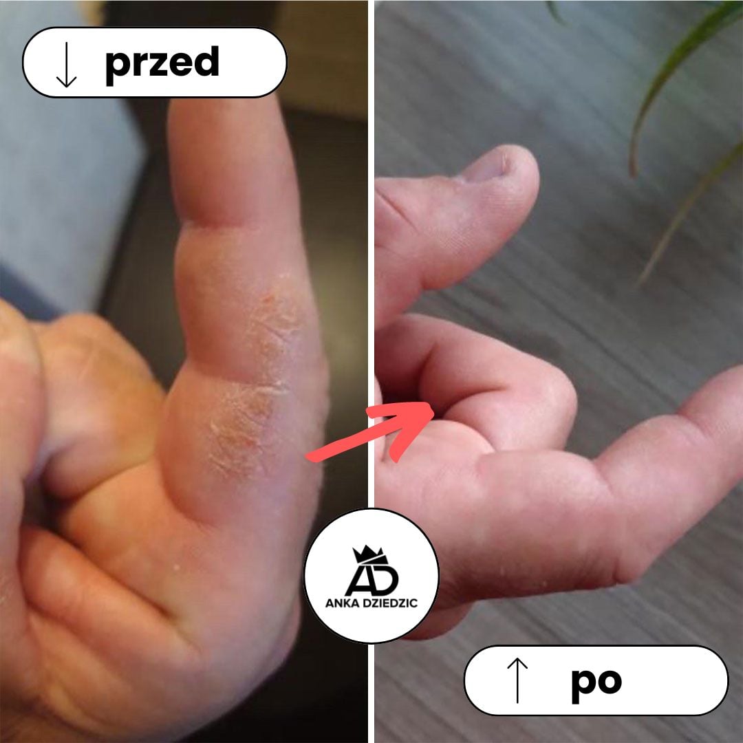 FitLab Krem Na Otarcia (krem nawilżający)