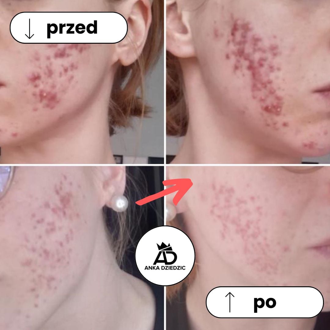 CareLab Pianka Do Mycia Twarzy 4X