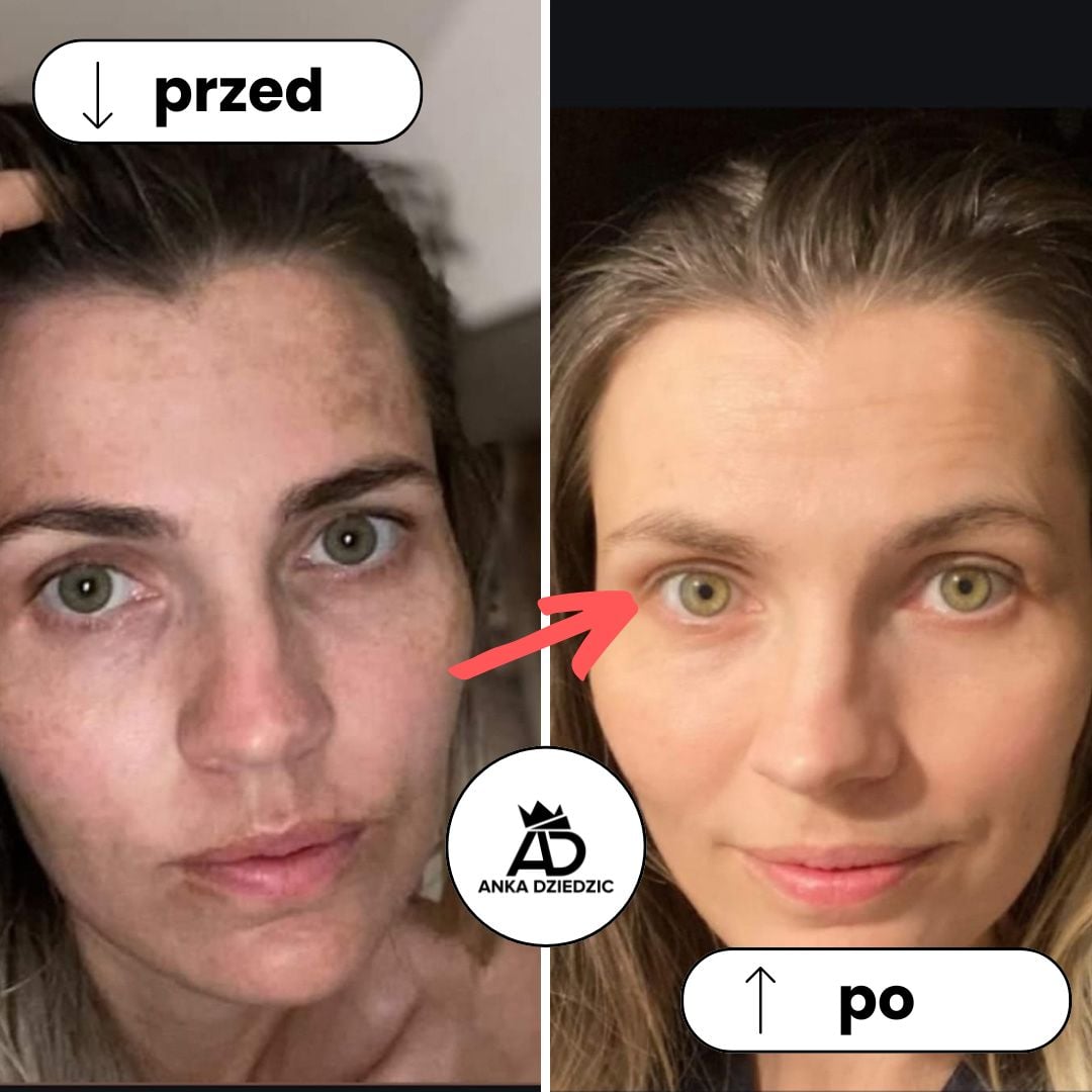 CareLab Krem Na Przebarwienia