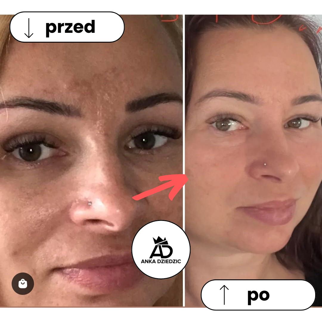 CareLab Krem Na Przebarwienia