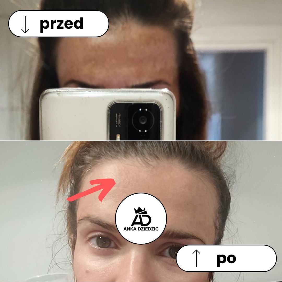 CareLab Krem Na Przebarwienia