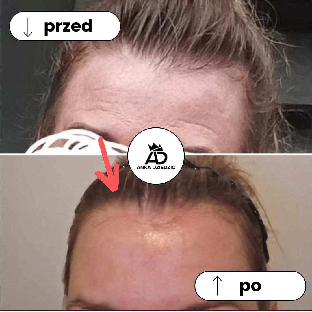 CareLab Serum Do Twarzy