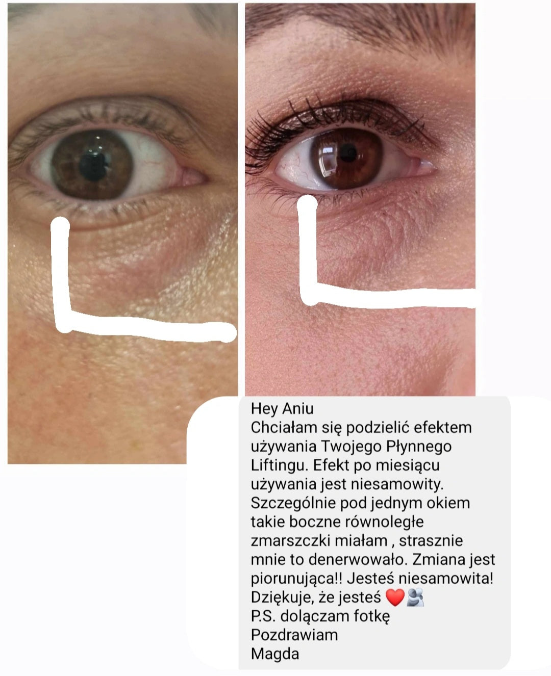 Efekt regularnego stosowania
