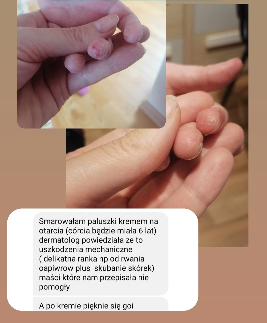 Efekt regularnego stosowania