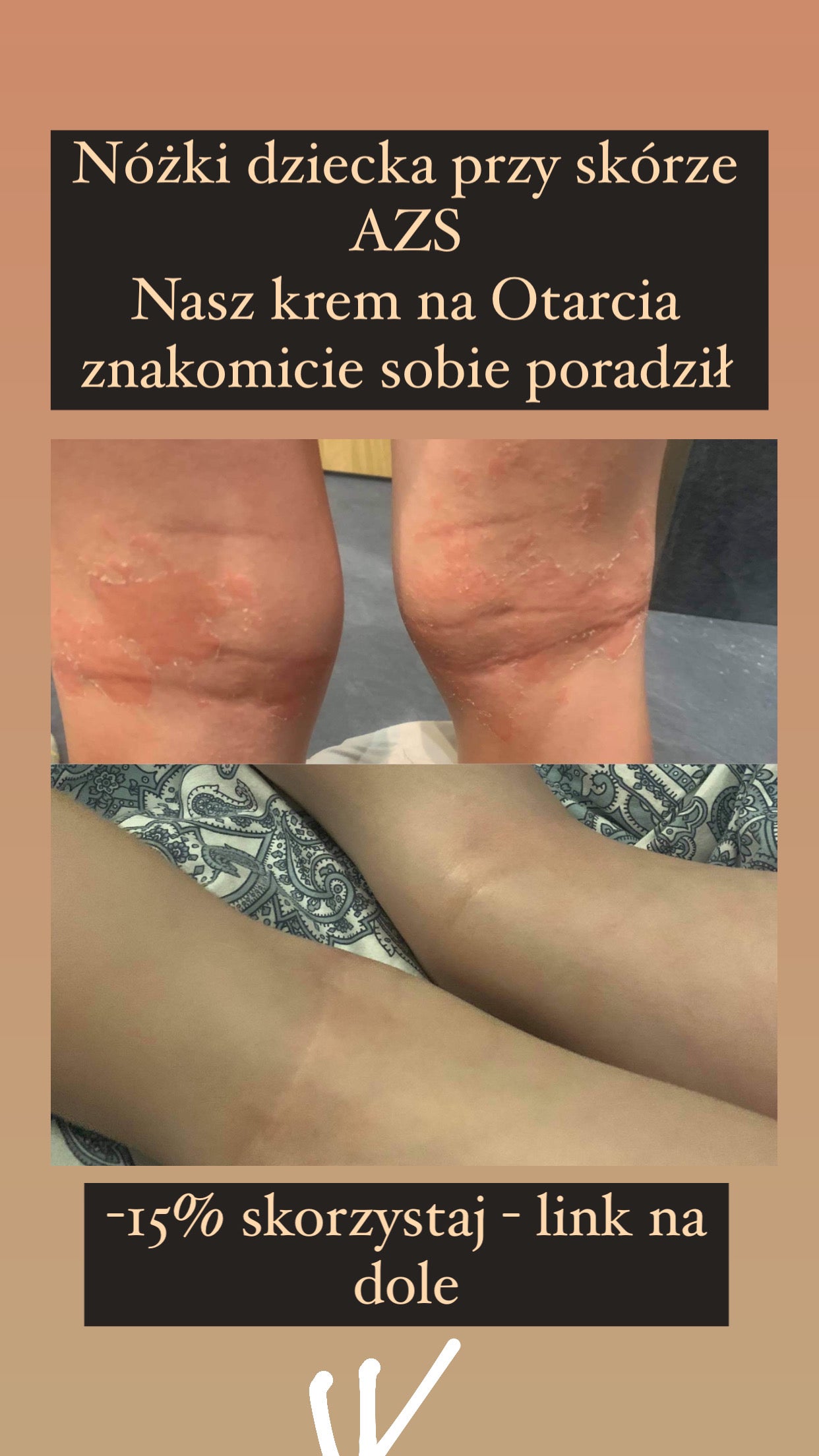 Efekt regularnego stosowania