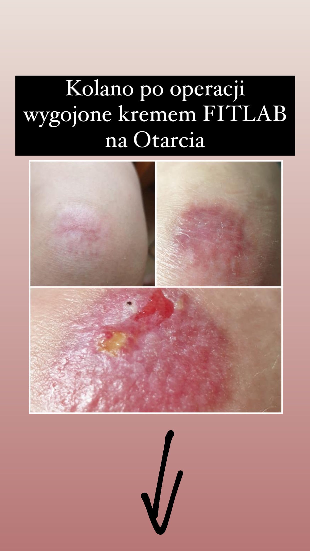 Efekt regularnego stosowania