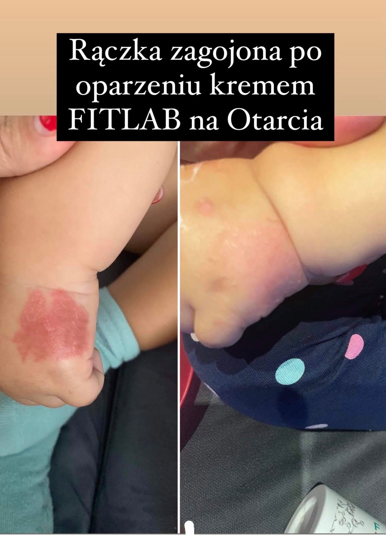 Efekt regularnego stosowania