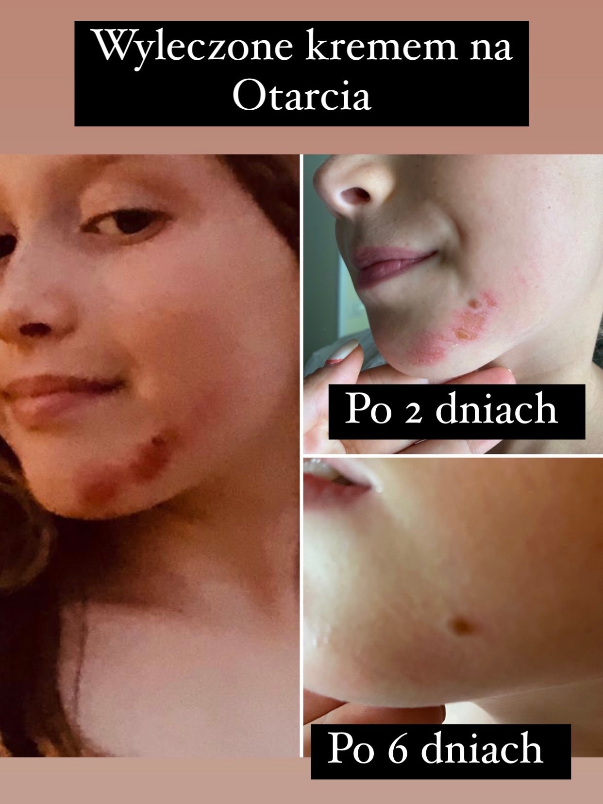 Efekt regularnego stosowania
