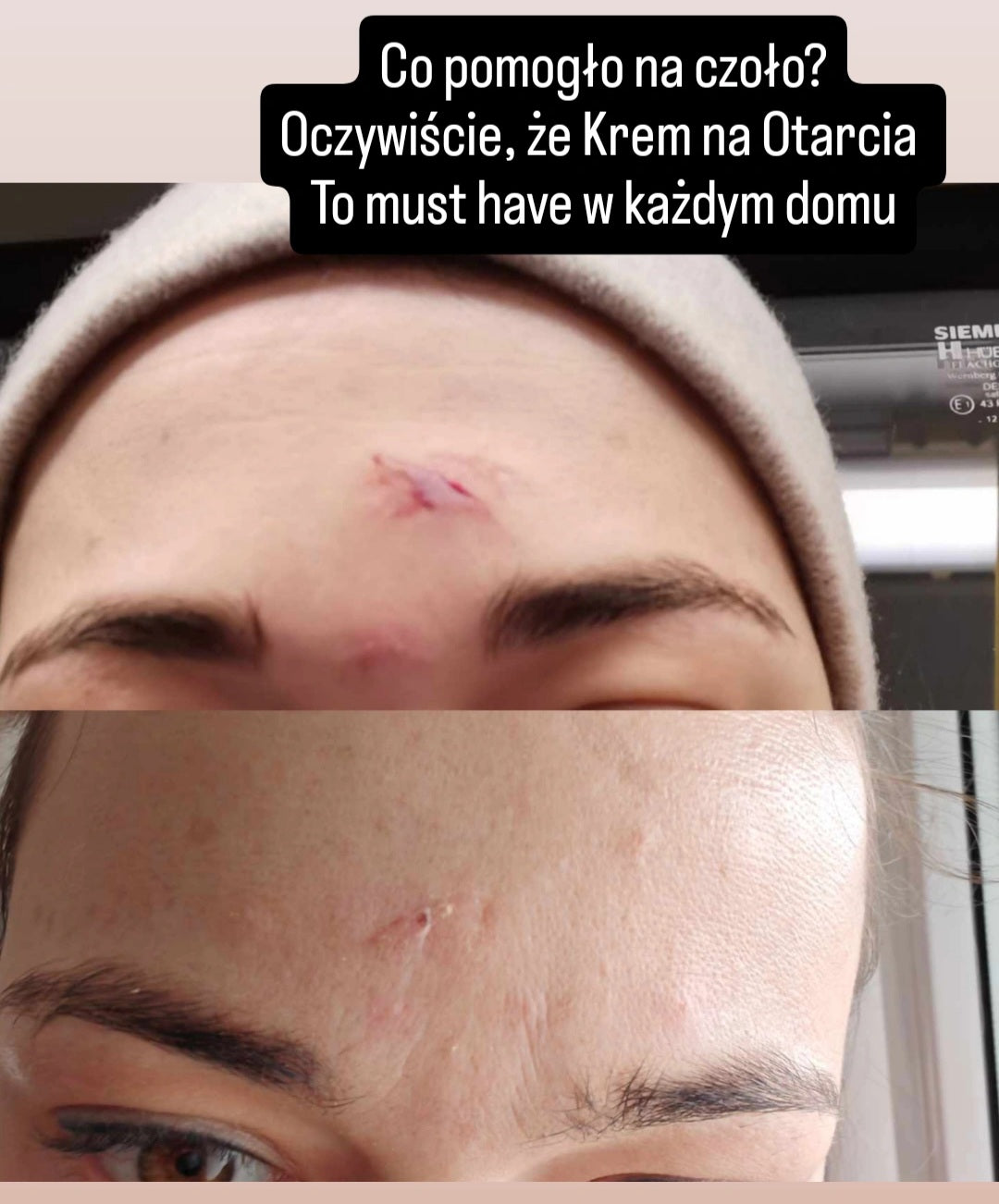 Efekt regularnego stosowania